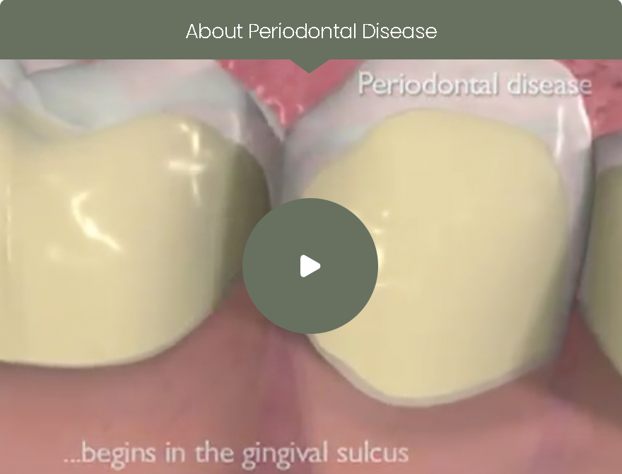 Periodontics | Dr. John M. Cherry, Jr., DMD - Brandon Dentist | null