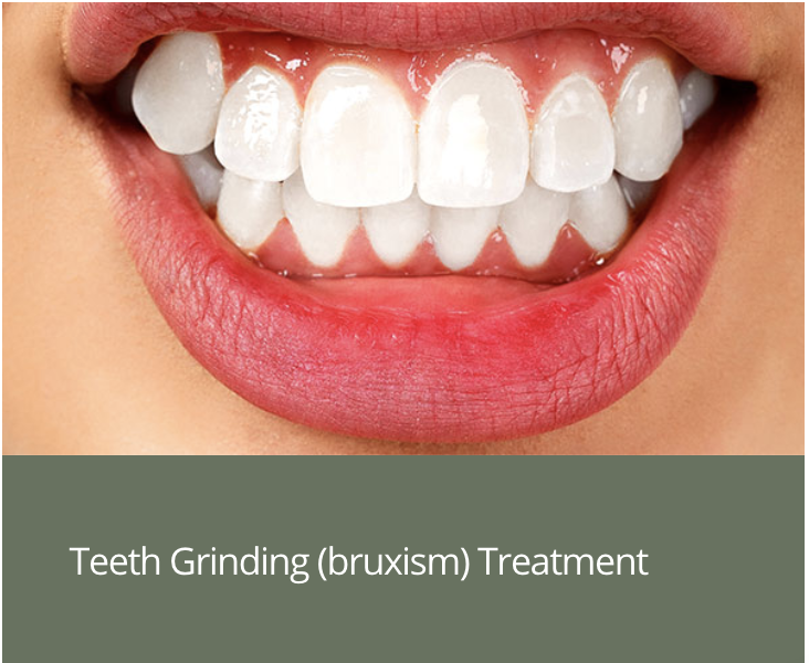 Meet Dr. John Cherry | Dr. John M. Cherry, Jr., DMD - Brandon Dentist | teeth grinding bruxism treatment