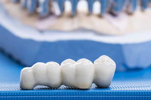row of glistening artificial teeth used for cosmetic dentistry