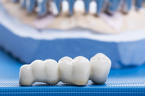 Cosmetic Dentistry | Dr. John M. Cherry, Jr., DMD - Brandon Dentist | cosmetic dentistry row of glistening artificial teeth used for cosmetic dentistry