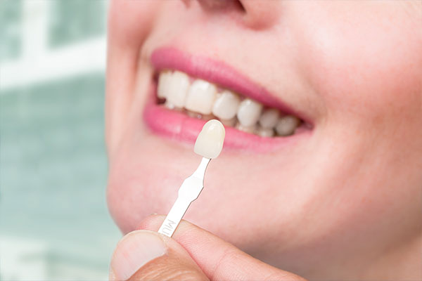 Cosmetic Dentistry | Dr. John M. Cherry, Jr., DMD - Brandon Dentist | cosmetic dentistry veneer held up in comparison to womans teeth for cosmetic dentistry