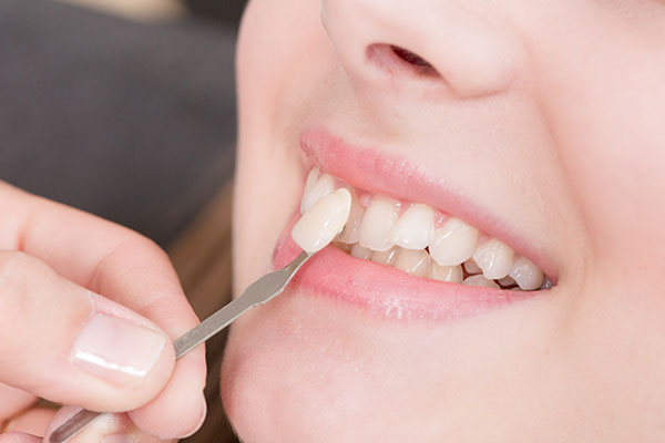 Smile Makeover With Your Brandon, FL Cosmetic Dentistry | Dr. John M. Cherry, Jr., DMD - Brandon Dentist | brandon,cosmetic dentistry dentist putting veneers up to woman's tooth