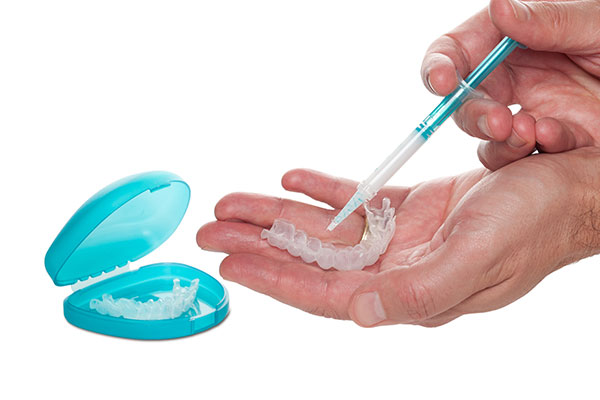 Teeth Whitening | Dr. John M. Cherry, Jr., DMD - Brandon Dentist | dentist adding whitening solution to teeth aligners