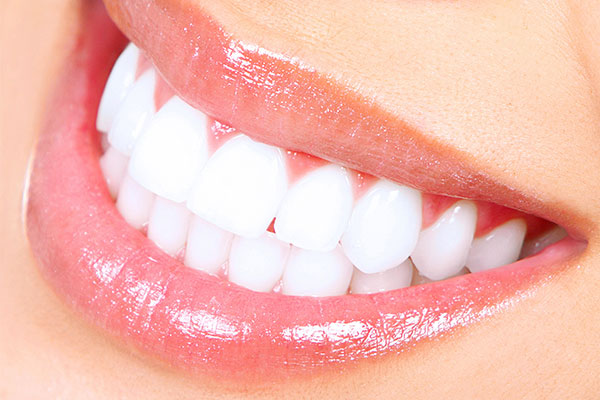 Teeth Whitening | Dr. John M. Cherry, Jr., DMD - Brandon Dentist | teeth after whitening