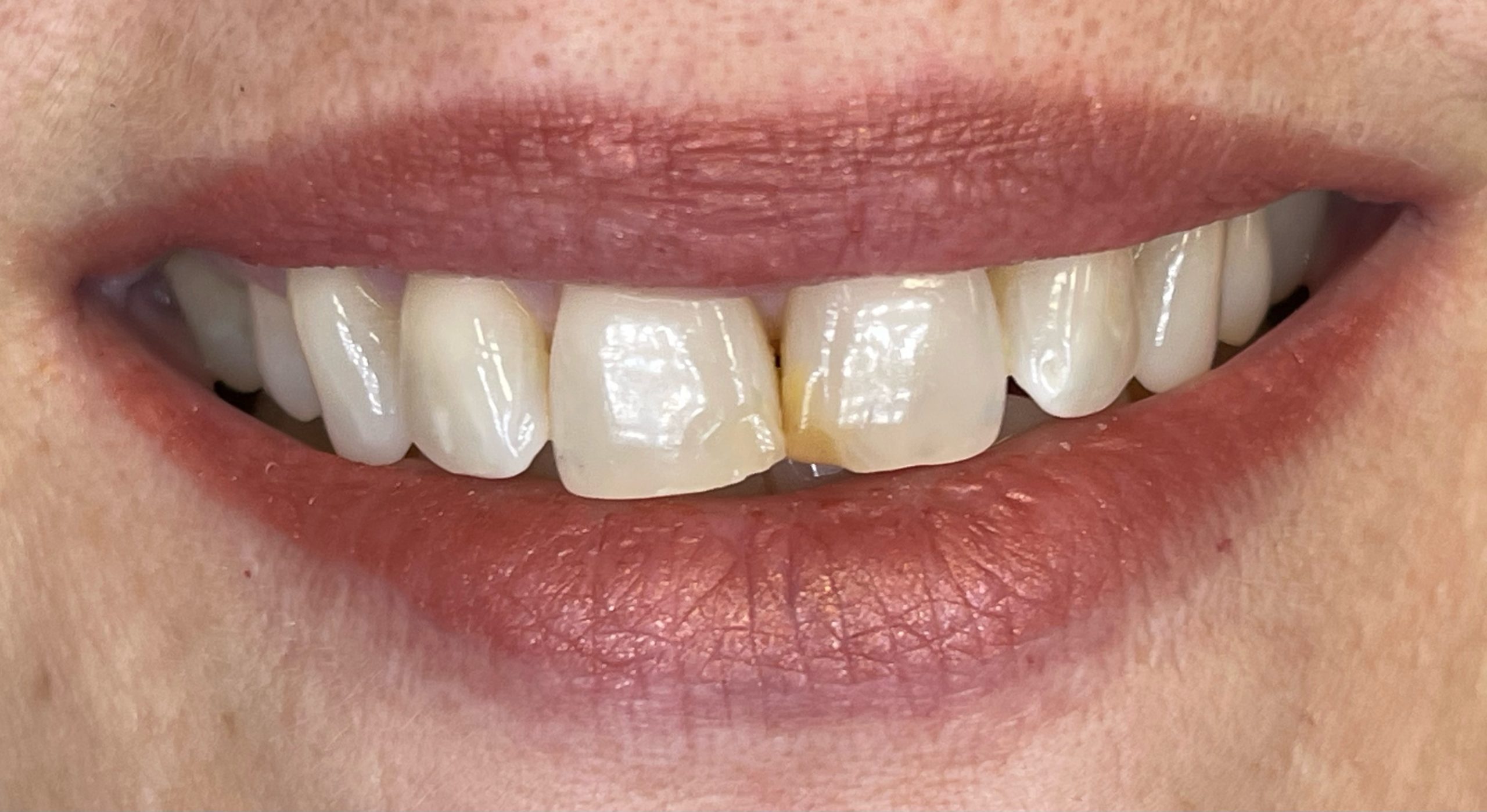 Dr. John M. Cherry, Jr., DMD - Brandon Dentist |