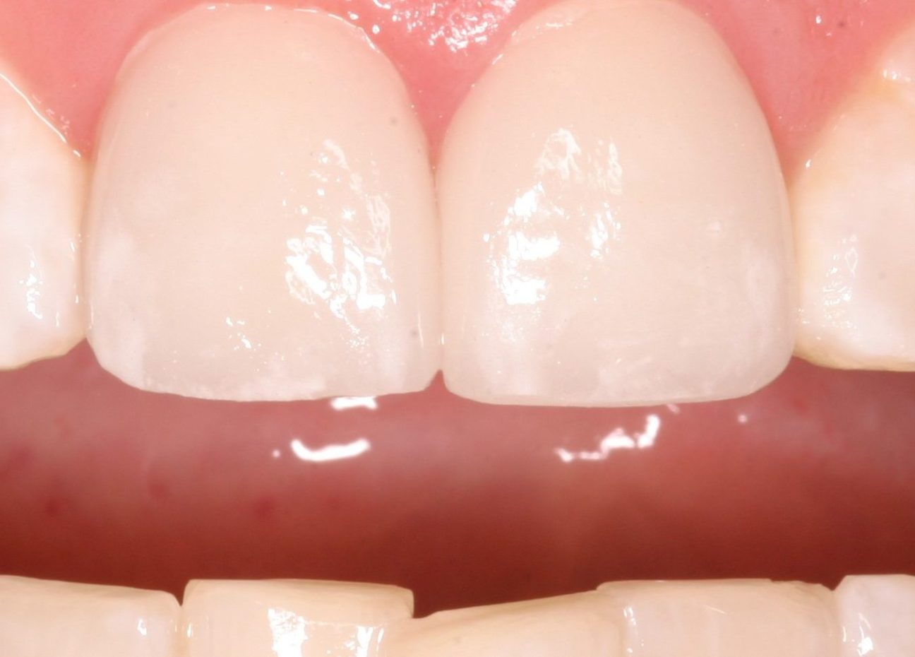 Dr. John M. Cherry, Jr., DMD - Brandon Dentist |