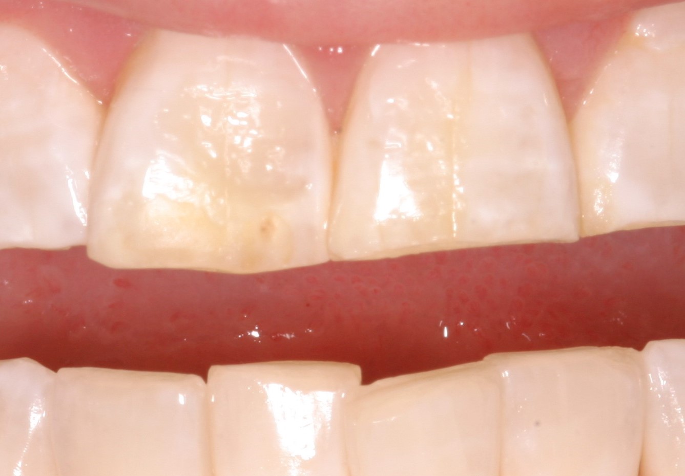 Dr. John M. Cherry, Jr., DMD - Brandon Dentist |