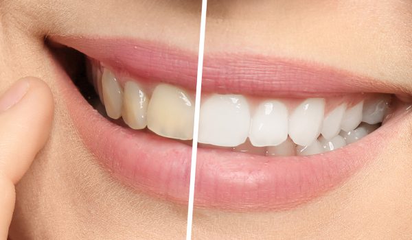 Dr. John Cherry, Jr., DMD - Dentist in Brandon FL