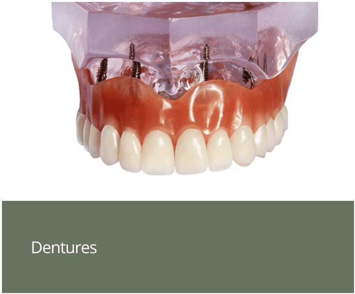 Dentures