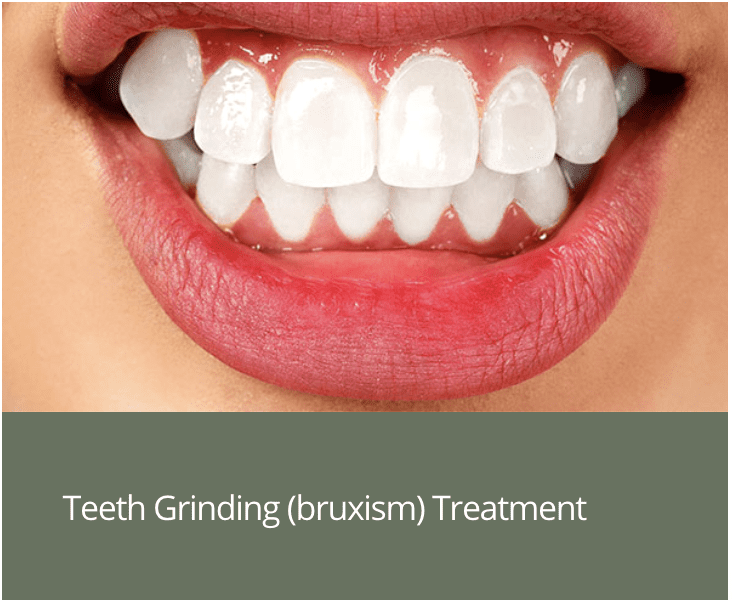 Teeth-Grinding-bruxism-Treatment