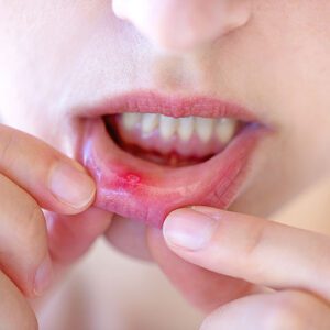 Family Dentist in Brandon, FL